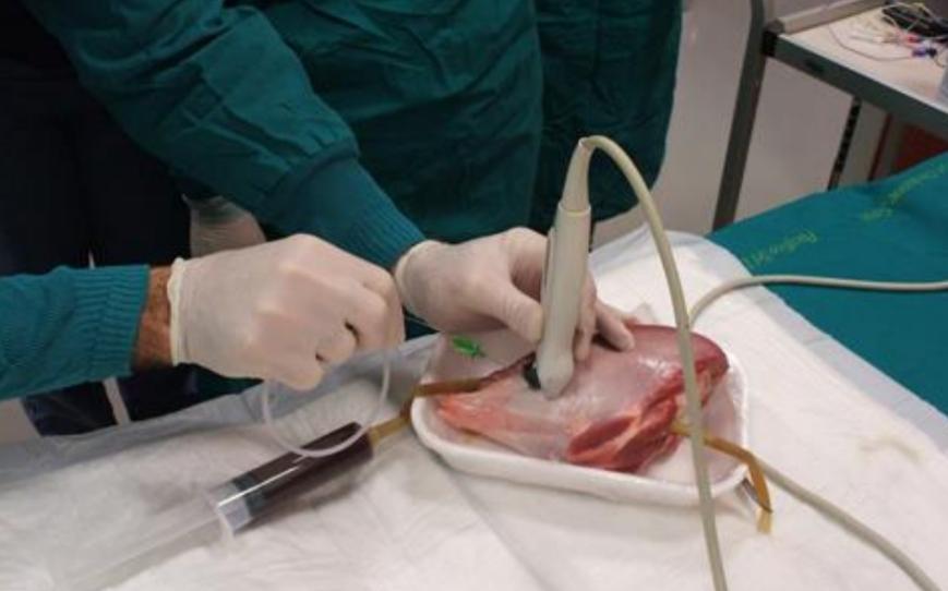 Medico si esercitava a saturare carne di manzo e pollo in sala operatoria