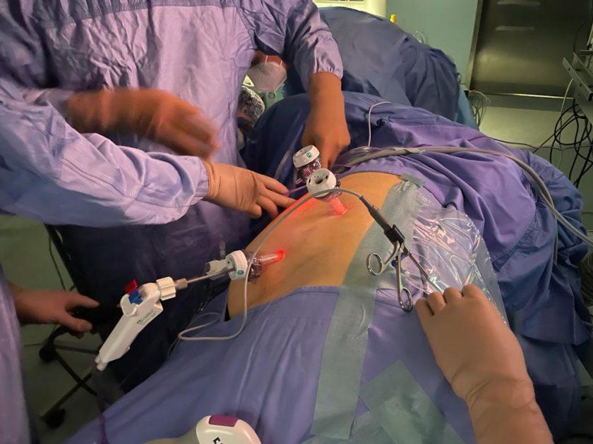 Innovativo intervento A Taranto: di rimozione del tumore del rene congelato e asportato con la tecnica della crioablazione laparoscopica